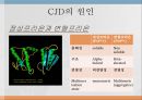 creutzfeldt-jacob disease 6페이지