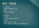백내장과 녹내장.ppt 7페이지