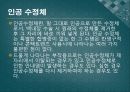 백내장과 녹내장.ppt 18페이지