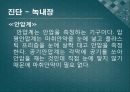 백내장과 녹내장.ppt 28페이지
