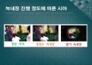 백내장과 녹내장.ppt 30페이지