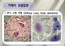 치매 환자 간호 (정의, 병태생리, 진단, 치료, 약물, 간호).ppt 12페이지