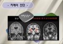 치매 환자 간호 (정의, 병태생리, 진단, 치료, 약물, 간호).ppt 19페이지