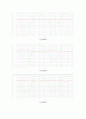 Common-Source Amplifier 11페이지