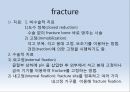 Fx. TM,Ankle(삼과골절).ppt 10페이지