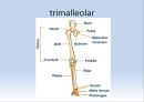 Fx. TM,Ankle(삼과골절).ppt 11페이지