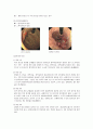 case_KGCC 위암(Stomach Cancer) 4페이지