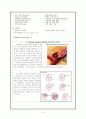 뇌동맥류 aneurysm casestudy 4페이지