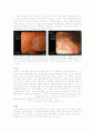 위궤양(gastric ulcer) 케이스 3페이지