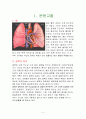 폐결핵 (Pulmonary Tuberculosis) 케이스 2페이지