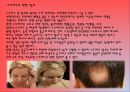 모발의 생장과 탈모에 미치는 영향.ppt 6페이지