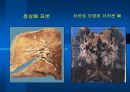 금연교육 7페이지