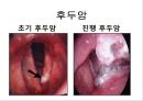 금연교육 15페이지