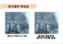 당뇨병과 당뇨합병증, 급성합병증, 만성합병증, 합병증관리 및 치료20130603 (1) 38페이지