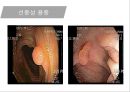 대장암, 대장내시경, 대장암치료20130524 28페이지