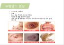 유방암, 바로 알고 이겨내자.ppt 25페이지