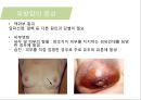 유방암, 바로 알고 이겨내자.ppt 27페이지