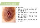 유방암, 바로 알고 이겨내자.ppt 28페이지