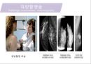 유방암, 바로 알고 이겨내자.ppt 37페이지