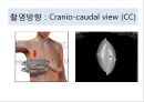 유방암, 바로 알고 이겨내자.ppt 38페이지