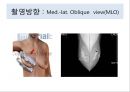 유방암, 바로 알고 이겨내자.ppt 39페이지