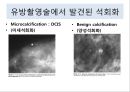 유방암, 바로 알고 이겨내자.ppt 40페이지