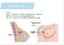 유방암, 바로 알고 이겨내자.ppt 53페이지