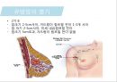 유방암, 바로 알고 이겨내자.ppt 54페이지