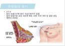 유방암, 바로 알고 이겨내자.ppt 56페이지