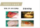 유방암, 바로 알고 이겨내자.ppt 63페이지