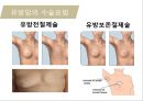 유방암, 바로 알고 이겨내자.ppt 64페이지
