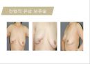 유방암, 바로 알고 이겨내자.ppt 65페이지