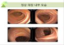 대장내시경에서 발견되는 소견 (대장 용종 및 대장암, 기타 소견).ppt 22페이지