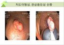 대장내시경에서 발견되는 소견 (대장 용종 및 대장암, 기타 소견).ppt 27페이지
