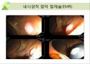 대장내시경에서 발견되는 소견 (대장 용종 및 대장암, 기타 소견).ppt 39페이지