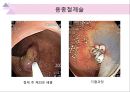 대장내시경에서 발견되는 소견 (대장 용종 및 대장암, 기타 소견).ppt 48페이지