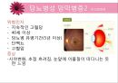 당뇨병과 합병증 - 당뇨 합병증의 종류와 환자 관리 (급성합병증, 만성합병증, 합병증관리 및 치료).ppt 22페이지