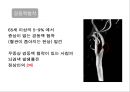 뇌혈관질환(뇌졸중) (Cerebrovascular disease).ppt 19페이지
