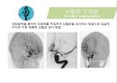 뇌혈관질환(뇌졸중) (Cerebrovascular disease).ppt 26페이지