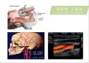 뇌혈관질환(뇌졸중) (Cerebrovascular disease).ppt 28페이지