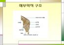 슬관절 조영검사 (Knee arthrography).PPT자료 3페이지