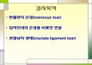 슬관절 조영검사 (Knee arthrography).PPT자료 4페이지