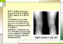 슬관절 조영검사 (Knee arthrography).PPT자료 8페이지
