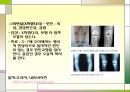 슬관절 조영검사 (Knee arthrography).PPT자료 10페이지