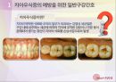 구강간호_질환으로 알아보는 구강간호방법 - 치아우식증의 예방을 위한 일반구강간호, 구내염 환자를 위한 특별구강간호, 의치 대상자를 위한 의치간호 4페이지