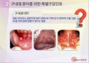 구강간호_질환으로 알아보는 구강간호방법 - 치아우식증의 예방을 위한 일반구강간호, 구내염 환자를 위한 특별구강간호, 의치 대상자를 위한 의치간호 9페이지