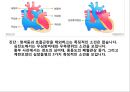 선천성 심장질환-8조 23페이지