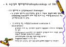 [뇌손상] 뇌손상 재활[Rehabilitation of TBI], 뇌손상의 종류와 원인 및 증상, 또는 치료에 관해 13페이지
