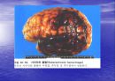 [뇌손상] 외상성 뇌손상[TBI]에 관해 7페이지