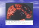 [뇌손상] 외상성 뇌손상[TBI]에 관해 8페이지